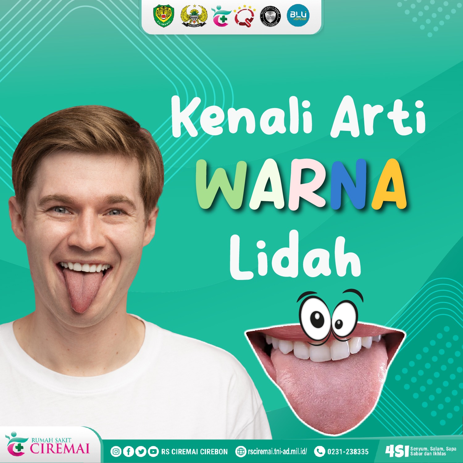 Arti Warna Lidah Berikut Cirikan Kondisi Kesehatanmu