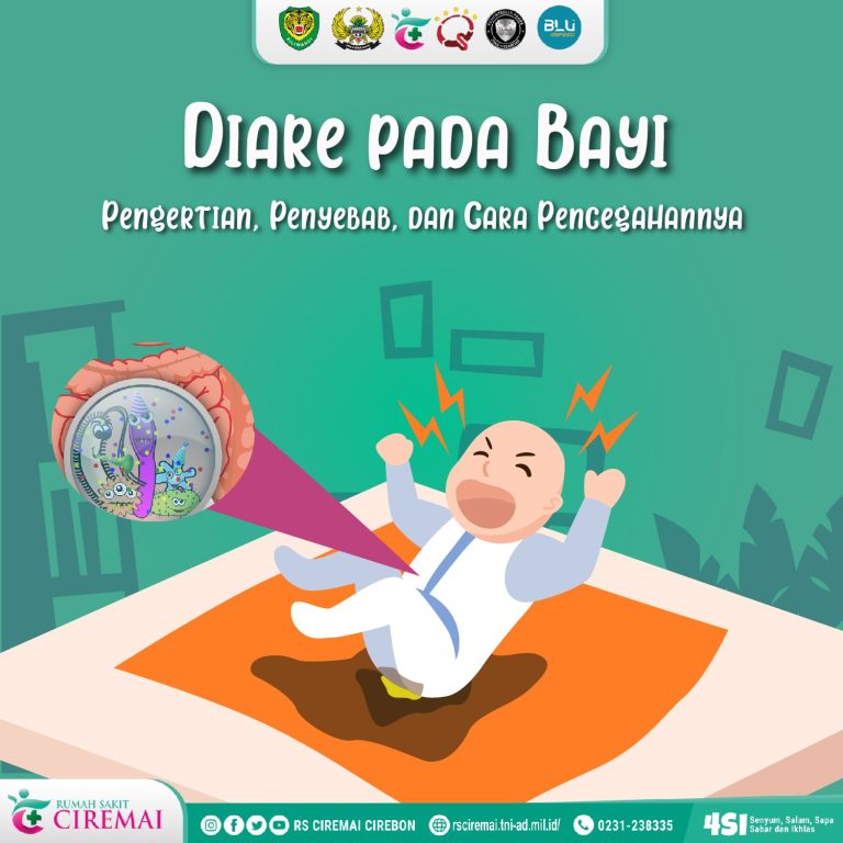 Diare pada Bayi: Pengertian, Penyebab, dan Cara Pencegahannya